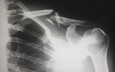 Best Supplements for Bone Health: Complete Mineral Stack for Osteoporosis Prevention